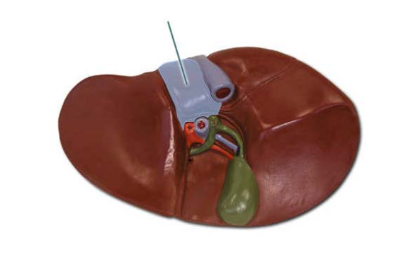 <p><span>Identify the highlighted liver lobe.</span></p>