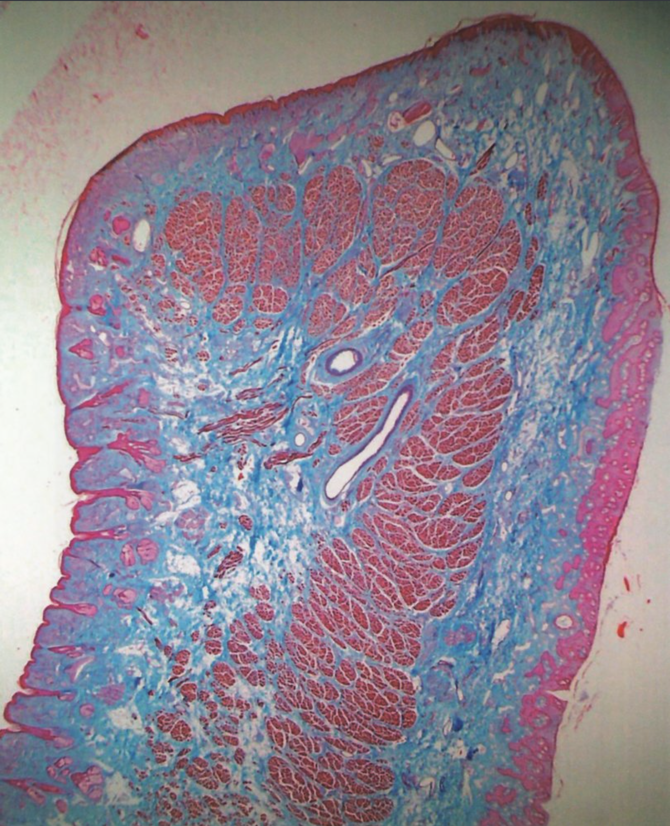 <p>B. The image shows a section through the lip.</p>