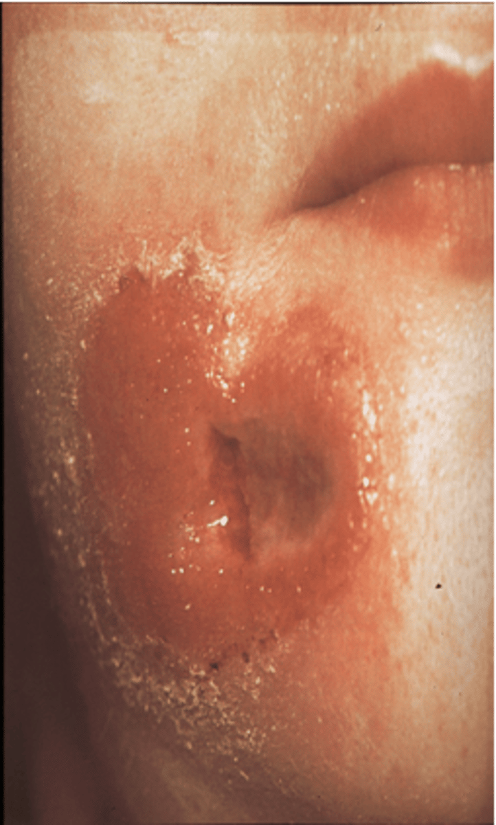 <p>not all will be symptomatic</p>