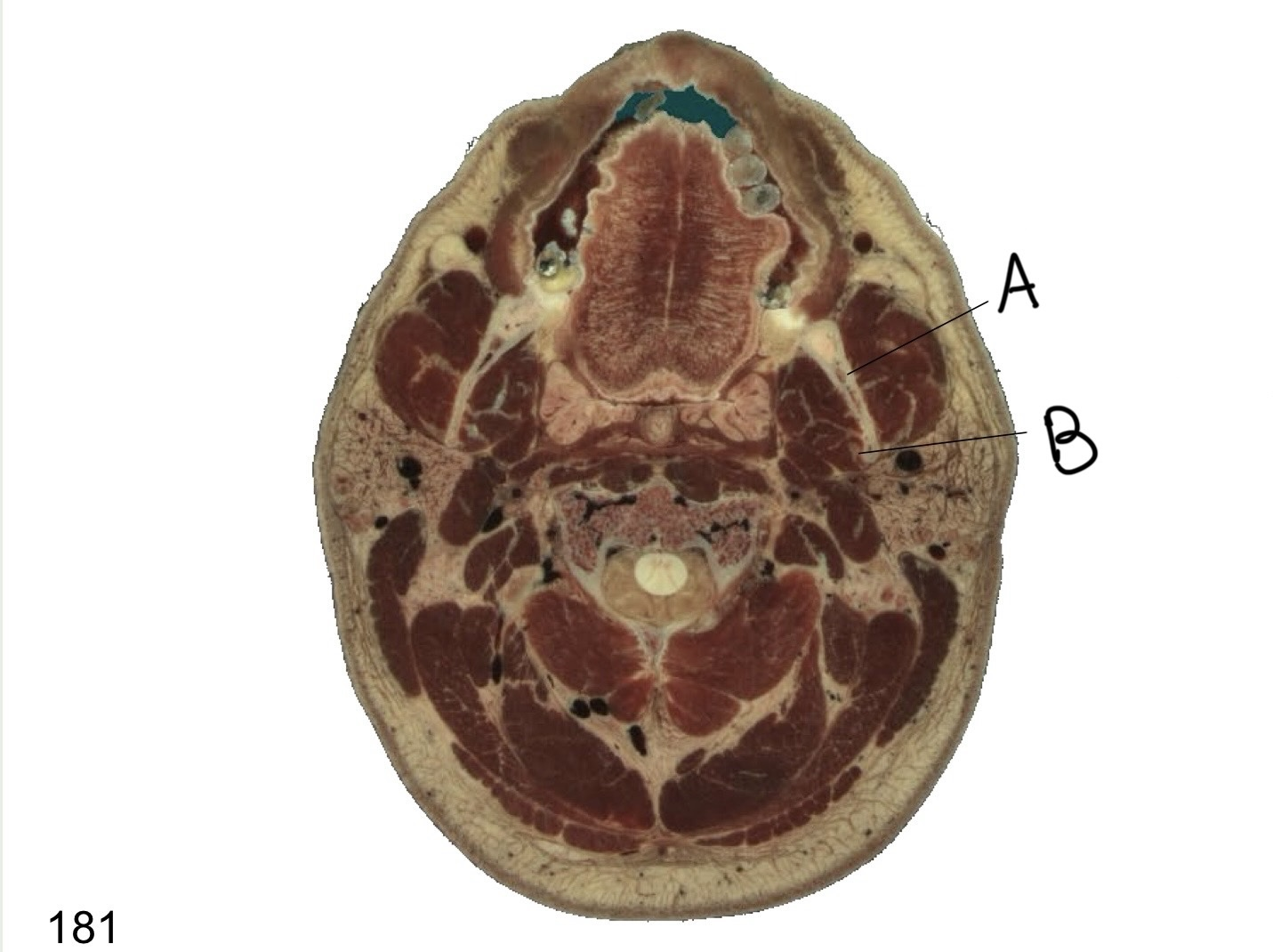 <p>what structure is labeled B?</p>