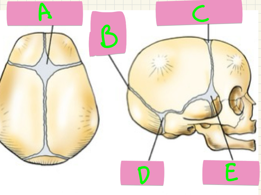 <p>What’s A-E?</p>