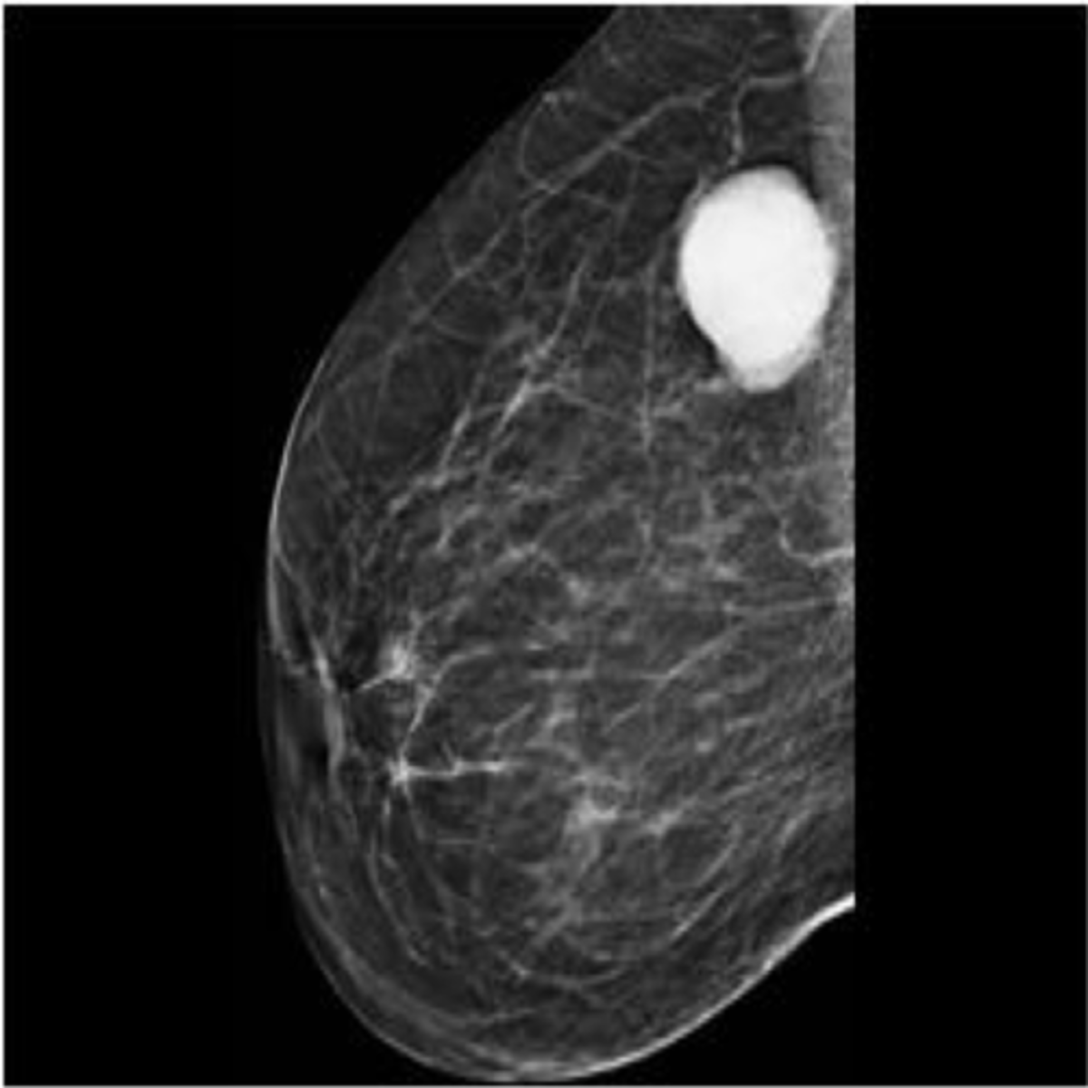 <p>breast imaging, small focal spot, low kVp</p>