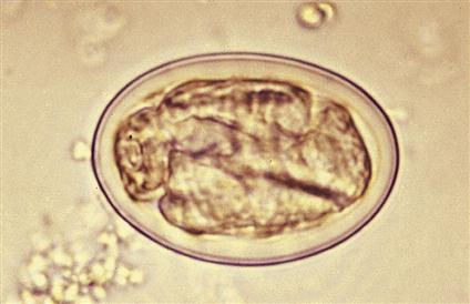 <p>Physaloptera spp.</p>