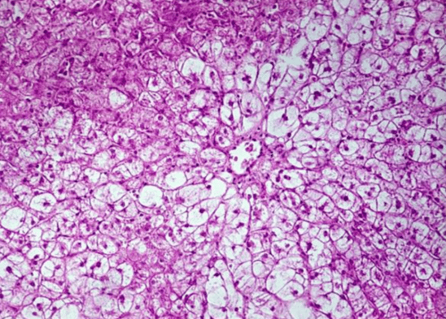 <p>glycogen or lipid inclusions?</p>