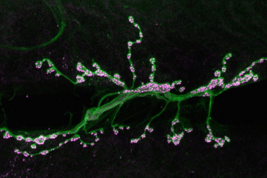 <p>Pain pathways become more responsive</p>