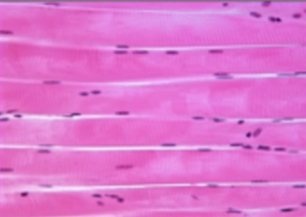 <p>fibers attached to skeleton; striated, voluntary.</p>