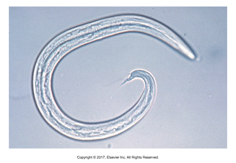 <p>Feline lung worm</p><ul><li><p>Affects: Cats only​</p></li><li><p>Found: Worldwide​</p></li><li><p>Cause of infection: Ingestion of larvae (360mm long)​</p></li><li><p>Adults live in respiratory bronchioles​</p></li><li><p>Larvated eggs​</p></li><li><p>S-shaped curve and dorsal spine on larvae​</p></li><li><p>Larvae present in fecal or tracheal wash​</p></li><li><p>Prepatent period: 30 days</p></li></ul><p></p>