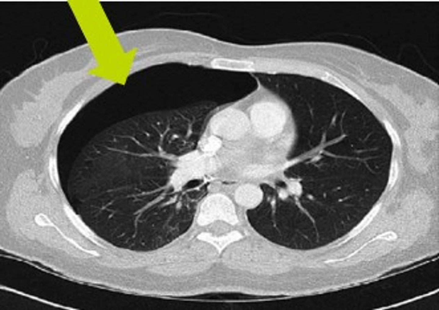 <p>Label pathology in image below</p>