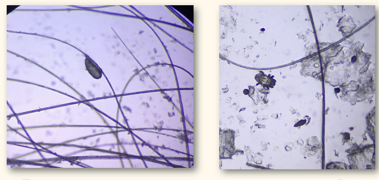 <p>Sample from a “dandruffy” rabbit! What can you see?</p>