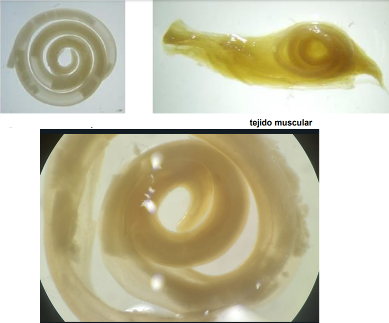 <ul><li><p>localización: tracto digestivo en huésped final</p></li><li><p>Huésped intermediario: 1° pequeños crustáceos, <strong>2° peces (L3)</strong></p></li><li><p>Hospedante definitivo: mamiferos marinos</p></li><li><p>Ciclo de vida indirecto</p></li><li><p>Filiformes y de color blanco o rosado</p></li><li><p>La boca es una pequeña abertura rodeada por 3 protuberancia labiales (dorsal y dos subventrales, entre estas dos últimas se encuentra un diente de penetración triangular)</p></li><li><p>El extremo de la cola es redondeado.</p></li></ul>