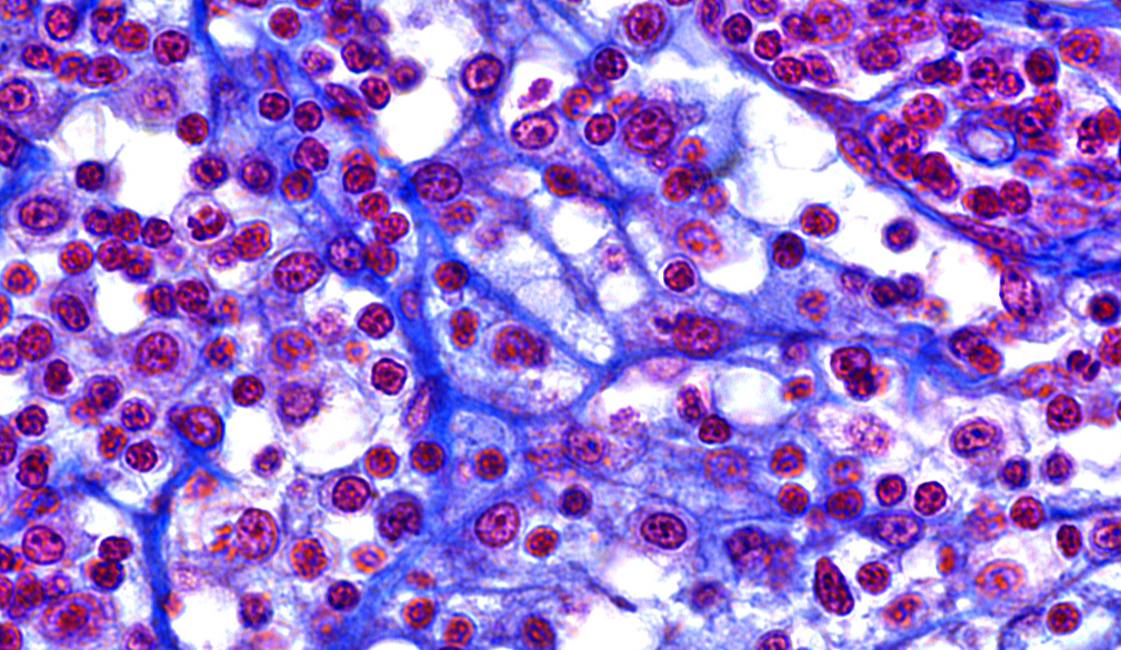 <p>What tissue is shown </p>