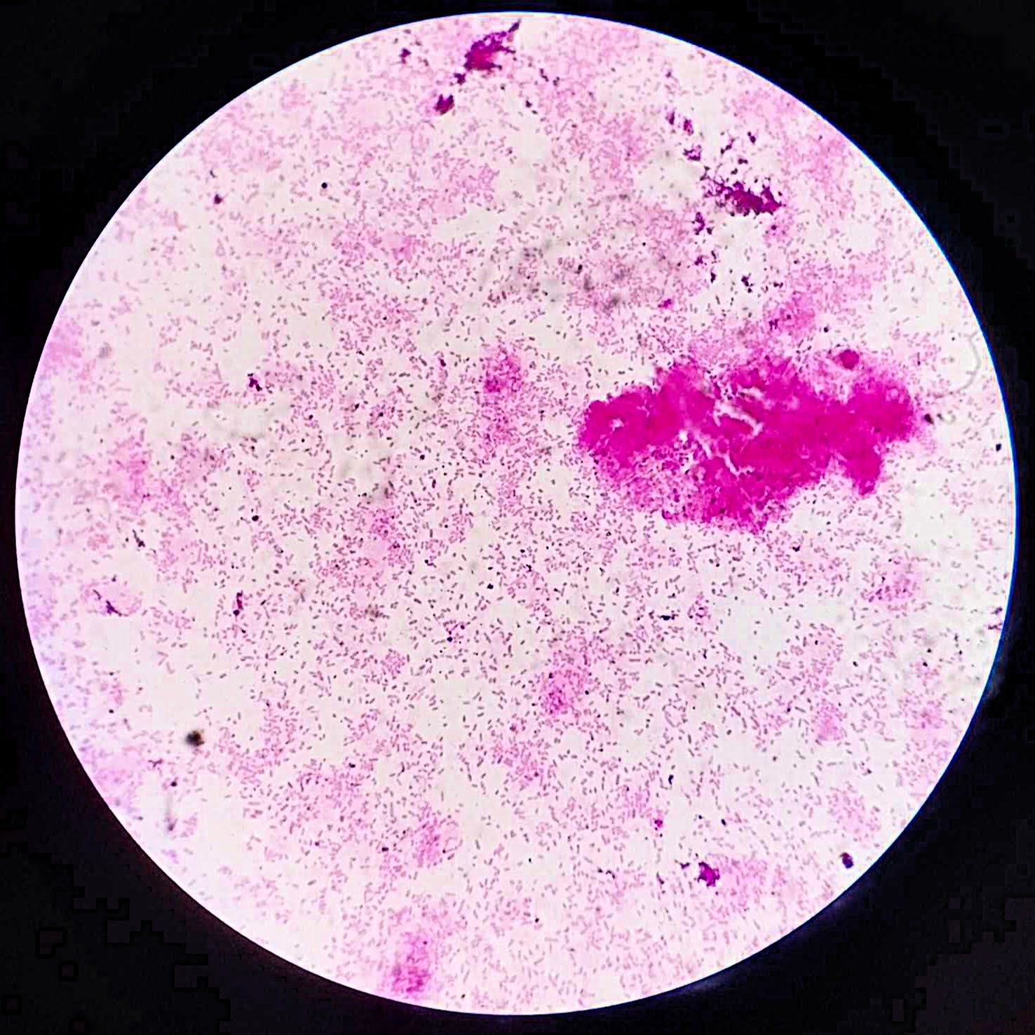 <p><em><mark data-color="#fecae0" style="background-color: #fecae0; color: inherit">Proteus vulgaris</mark></em><br></p><ul><li><p>rod</p></li><li><p><span style="font-family: Arial, sans-serif">in singles, or in clusters</span></p></li><li><p>pink or red</p></li><li><p>gram negative</p></li><li><p>urinary tract infections (UTIs), cause wound infections, respiratory tract infections</p></li></ul><p></p>