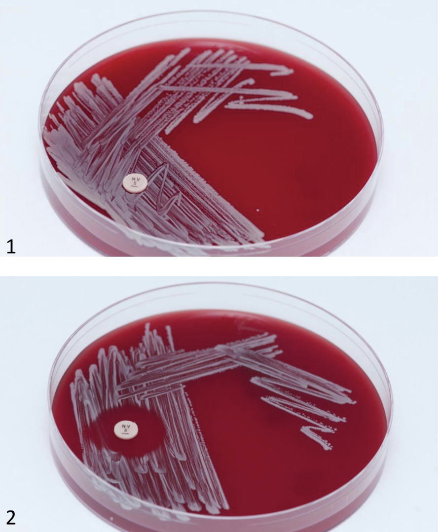 <p>Differentiate between coagulase negative staphylococcus ( staphylococcus epidermidis and staphylococcus saprophyticus)</p>