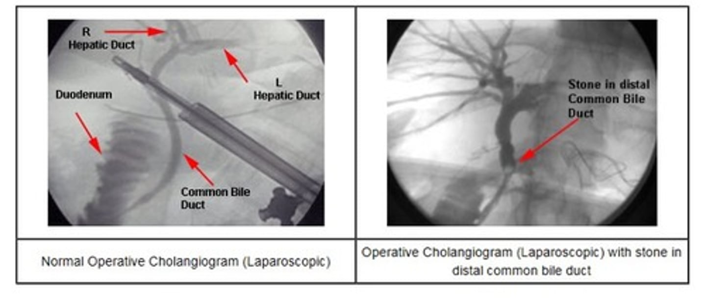 <p>what procedure (study image incase labeling is asked)</p>