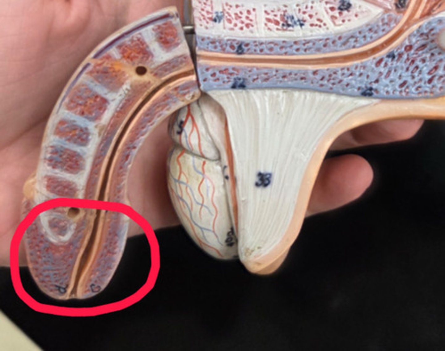 <p>What is circled?</p>
