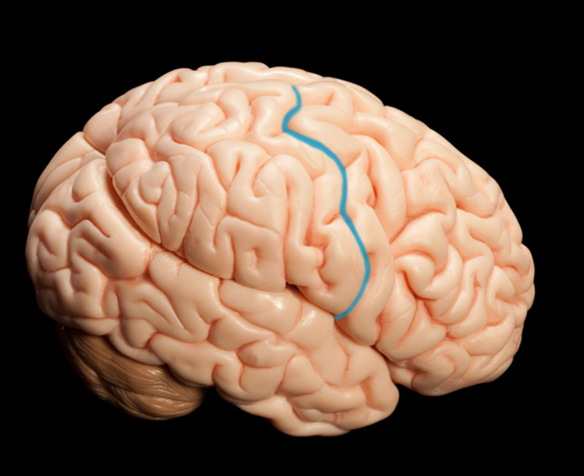 <p>what SLICES on the parietal lobe after the precentral gyrus </p>