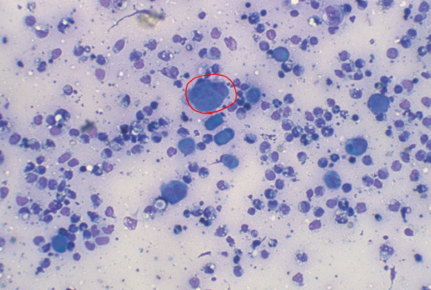 <p>Hoe heten deze cellen (te zien bij een microscopisch nazicht na een Tzanck smear)</p>