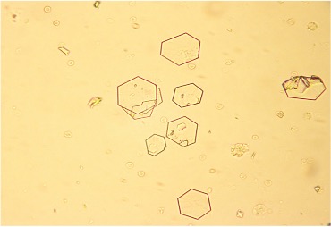 <p>hexagon</p>