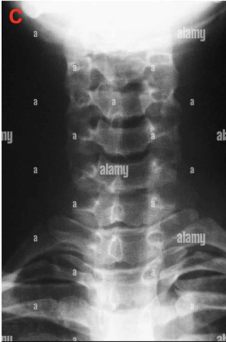 <p>Identify the positioning errors</p>