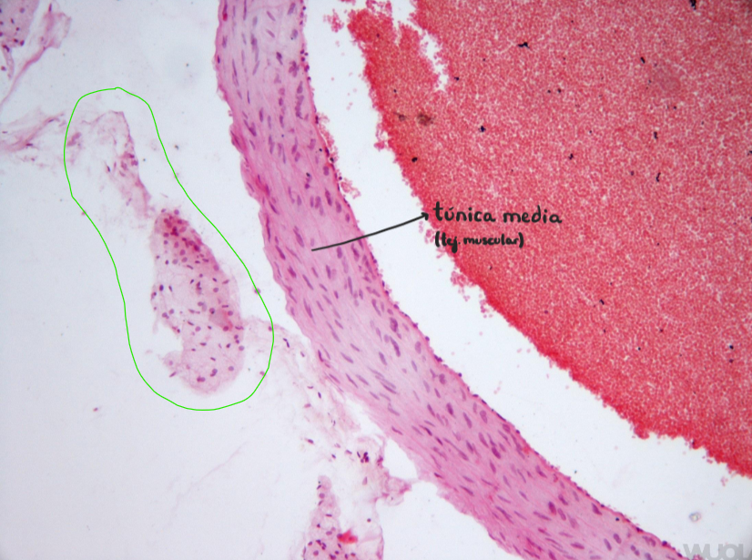 <p>Arteria pulmonar (muscular)</p><p>Rodeado en verde - túnica adventicia desprendida</p>