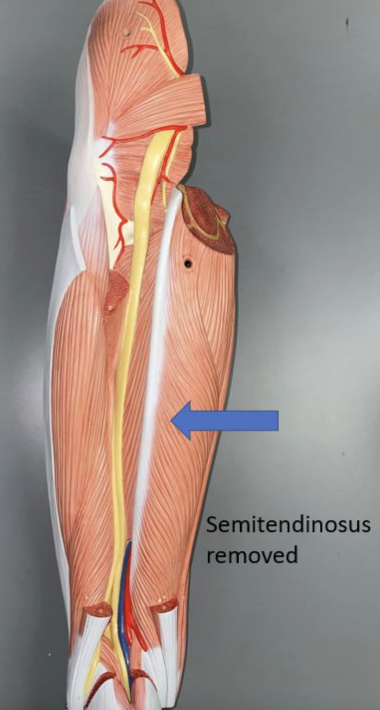 <p>muscle name &amp; action</p>