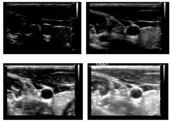 <p>describe the SNR of the following images in the following order: top left, top right, bottom left, and bottom right</p>