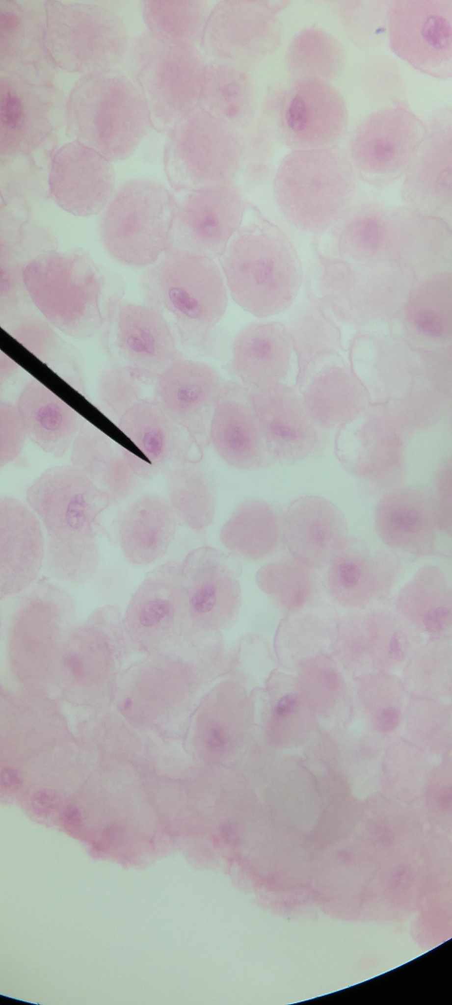 <p>aka resting cell stage; period between mitotic divisions; nucleus enlarges due to the synthesis of proteins and nucleic acids, large molecules found in every nucleus, and duplication of each chromosome</p>