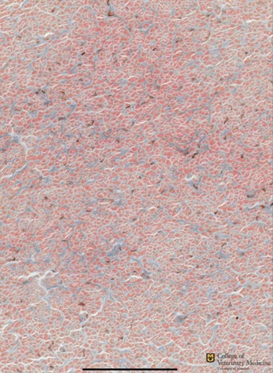 <p>What cartilage type is depicted?</p><p>What is the tissue type stained blue?</p>