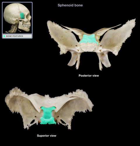 depression in the sphenoid bone where the pituitary gland is located