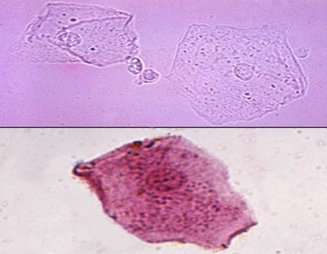 term image