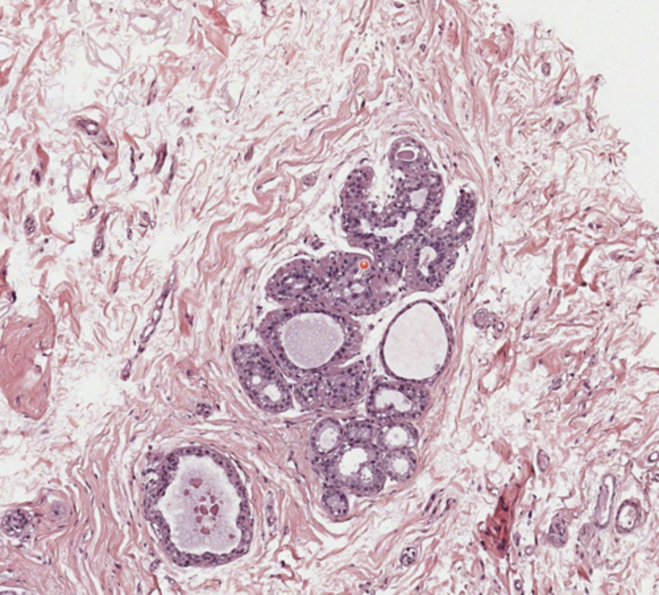 <p>Breast</p>