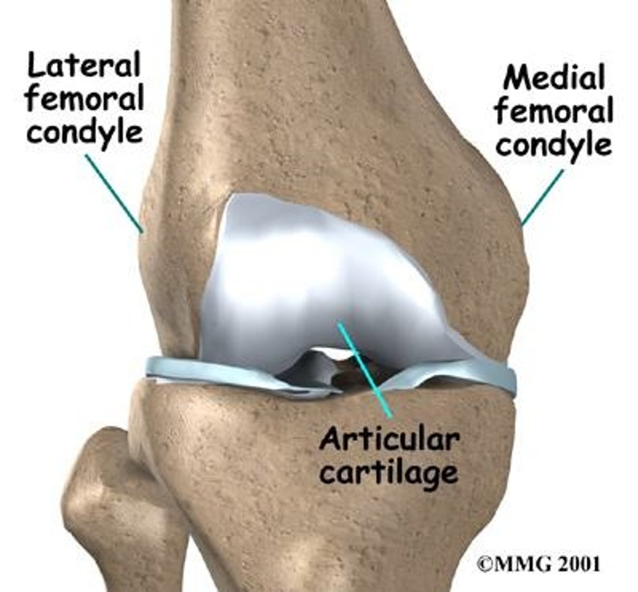 <p>Large, round protuberance with smooth articular surface at the end of the bone.</p>