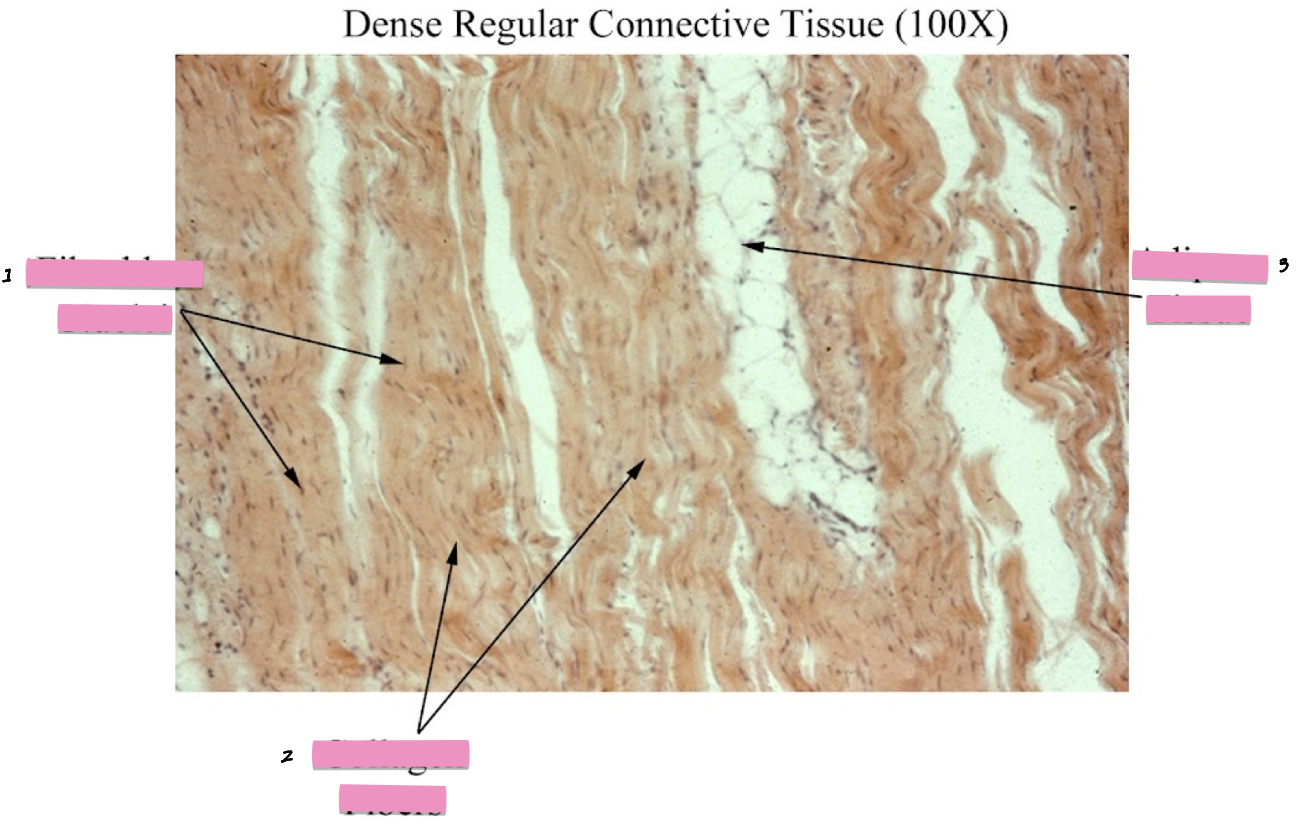<p>(1) Dense regular connective tissue cellular characteristics</p>