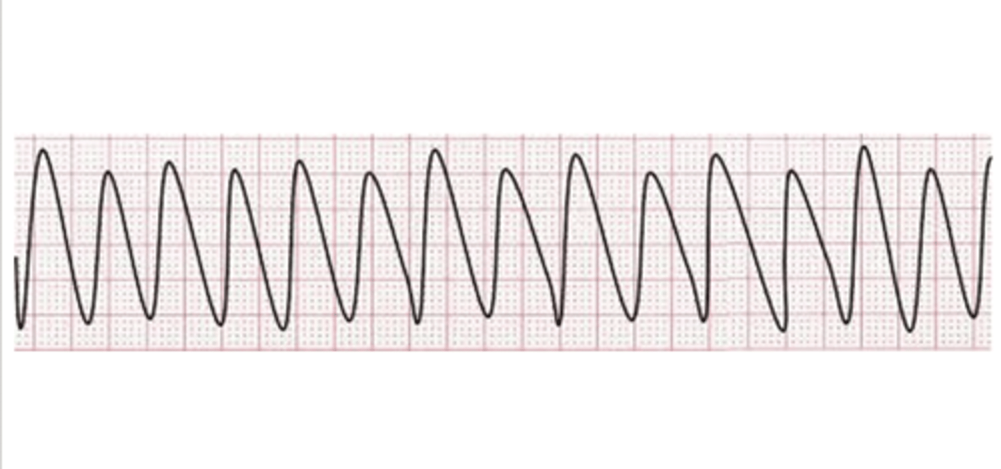 <p>Rhythm?</p><p>Management?</p>