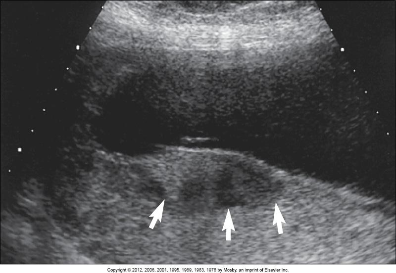 <p>what does this image show?</p>