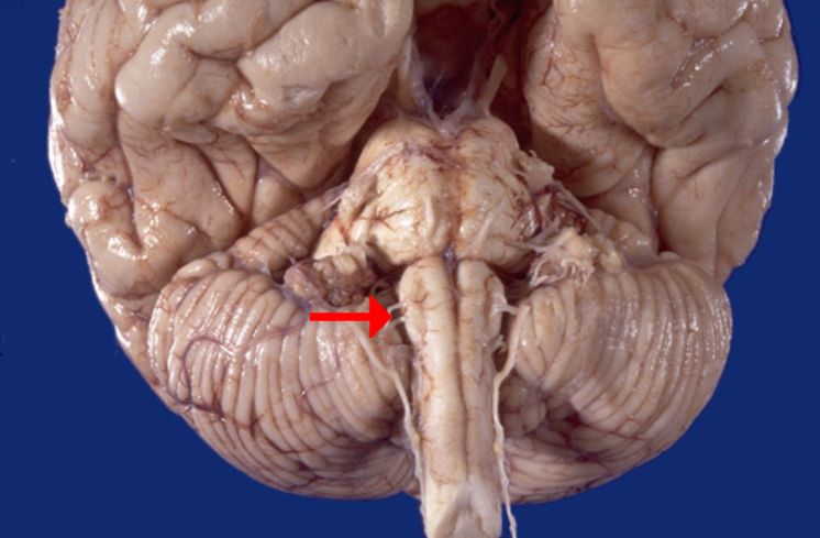 <p>Label this structure</p>
