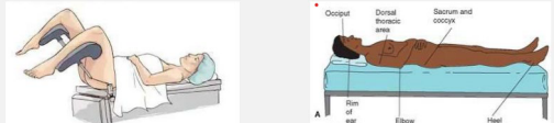 <p><strong>Positioning the Patient</strong></p><p>-Females should be in the ________ position to get a catheter, while males should be in the _____ position. </p>