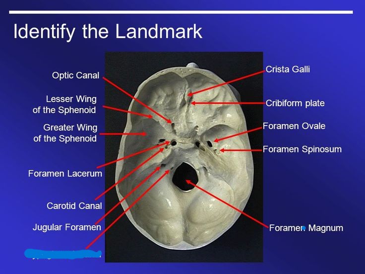 <p>What part of the skull is this?</p>