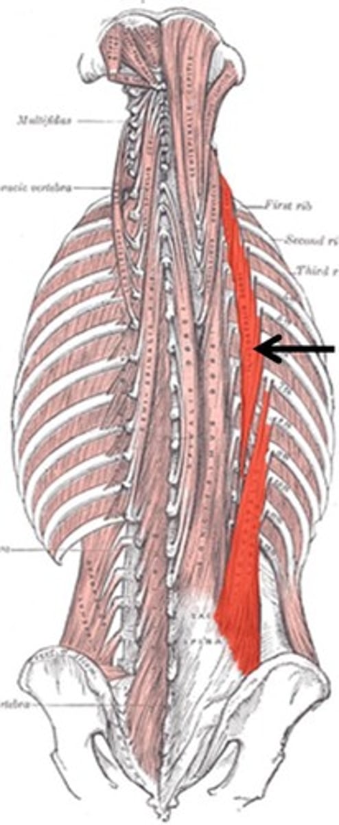 <p>Spine extension and lateral flexion (unilateral)</p>