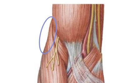 <p>distal, lateral humerus</p>