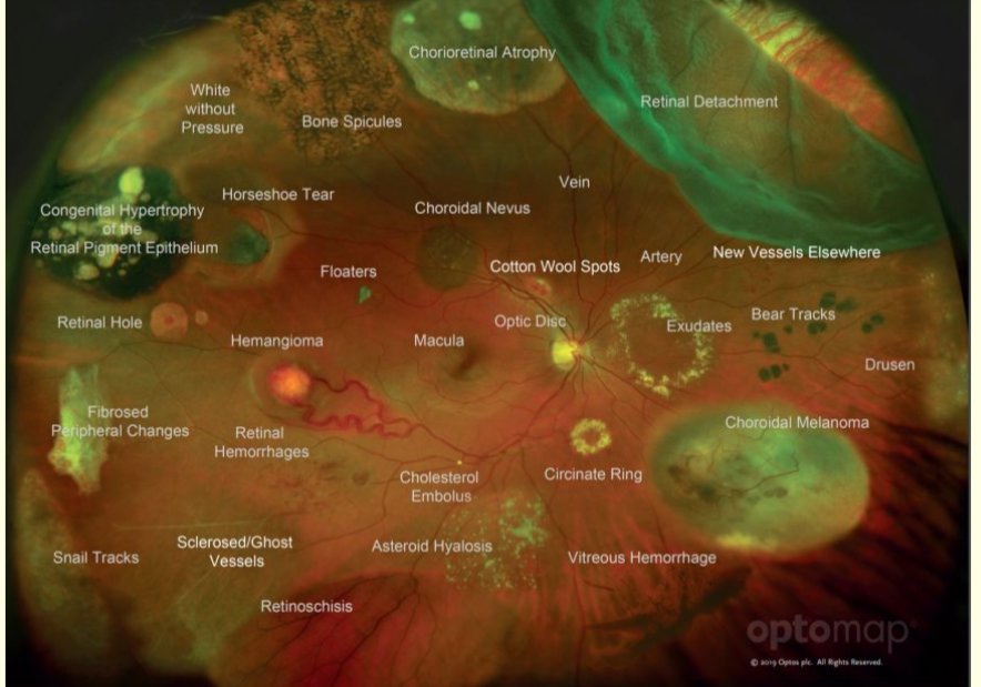 <p>What technique is being used here? </p>