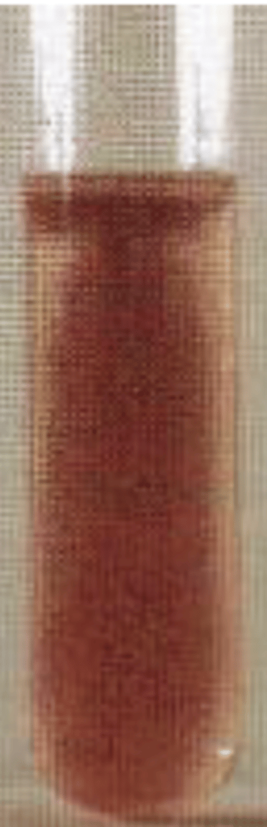 <p>E. coli</p>