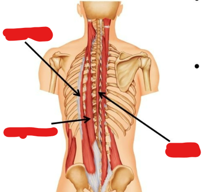 <p>What are the different muscles in the <em>Erector Spinae</em>?</p>