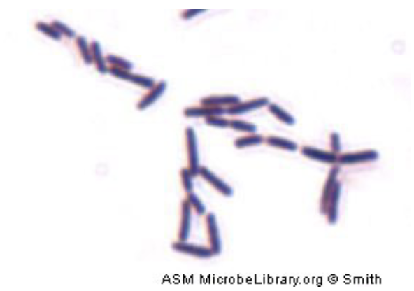 gram positive bacillus