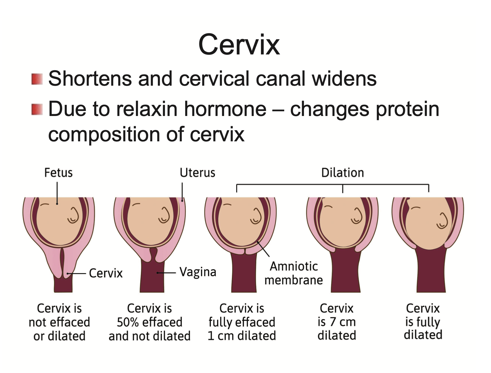 <p>Shortens and cervical canal widens</p><ul><li><p>due to <strong>relaxin</strong> hormone → changes protein composition of cervix</p></li></ul><p></p>