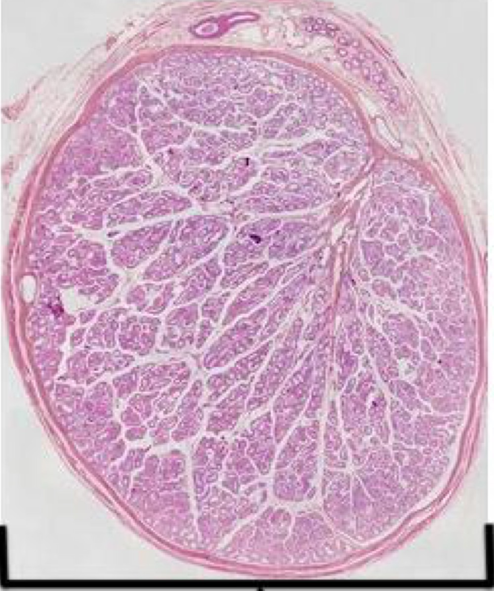 <p>Testis </p>