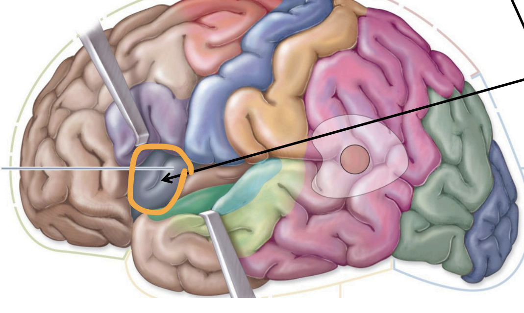 <p>Insula</p>