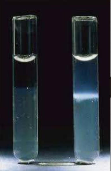<ol><li><p>Name of the test</p></li><li><p>Type of reaction</p></li><li><p>The Ag is pesent in soluble form called……</p></li><li><p>The Ab in this reaction is called…..</p></li><li><p>Test is used for ……</p></li></ol>