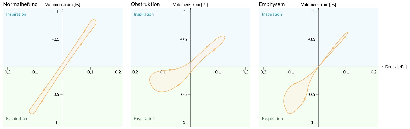 <p>C. 0.2 kPa·s/L</p>