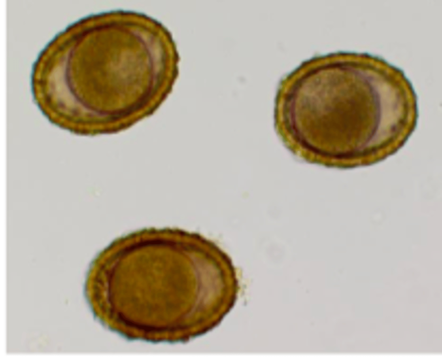 <p>Baylisascaris procyonis (Raccoon Roundworm)</p>